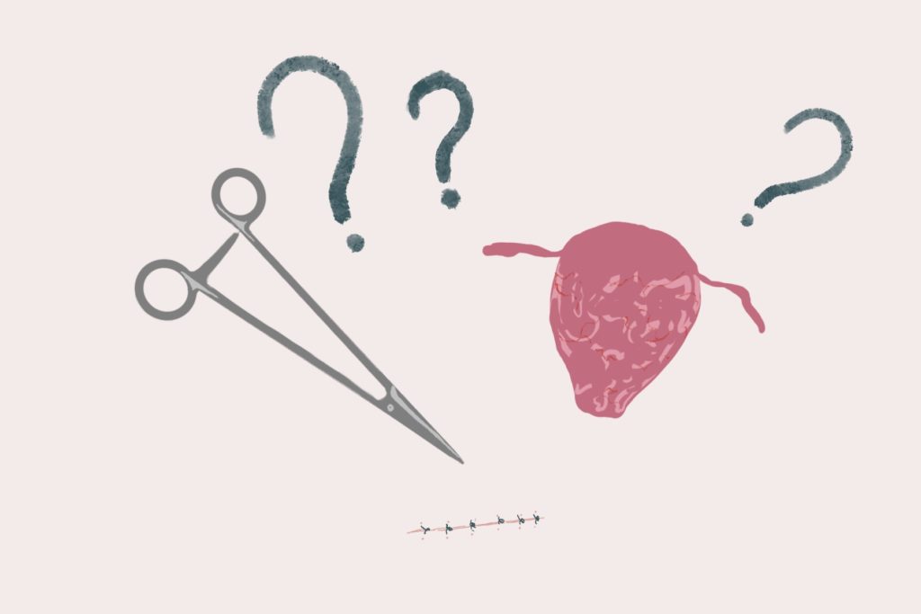 Graphic with surgical instrument, uterus, and question marks